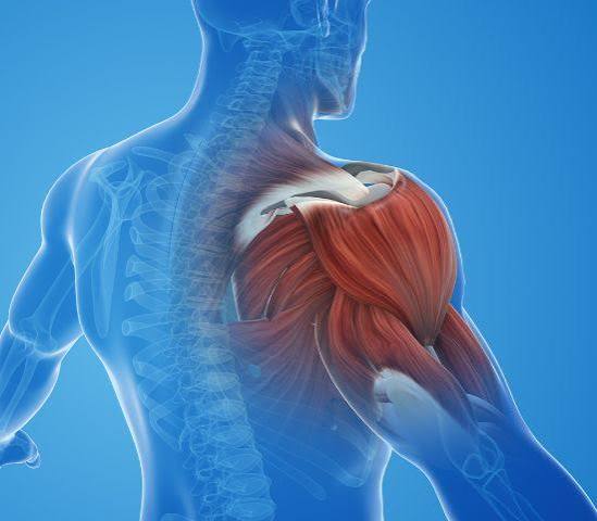 Shoulder Impingement in Gurgaon | Expert Physiotherapy for Lasting Shoulder Pain Relief