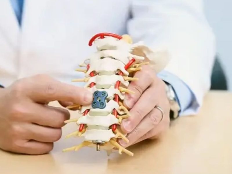 Spinal Fusion Surgery cost india