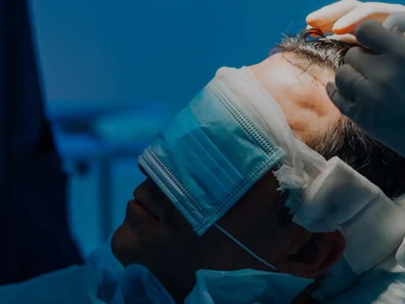 Say Goodbye to Baldness with Premier Hair Transplant in Delhi!