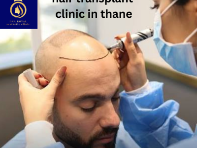 Best Hair Transplant Clinic in Thane | DNA Royal Hair Restoration.