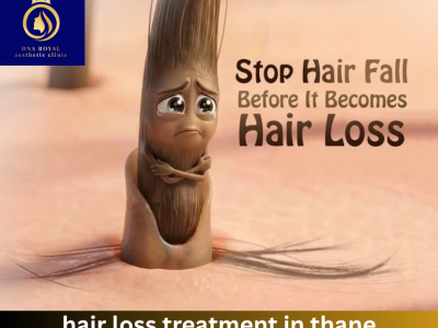 Advanced Hair Loss Treatment in Thane | DNA Royal Clinic.