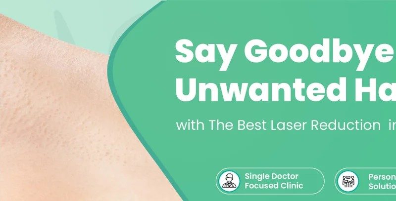 Laser Hair Removal: A Safe and Long-Lasting Solution for Smooth Skin