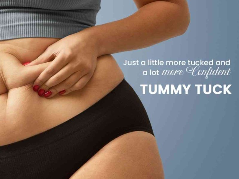 Tummy Tuck Surgery Cost in Hyderabad