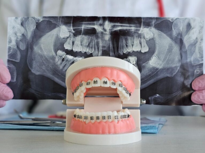San Antonio Adult Orthodontist for a Healthier, More Confident Smile
