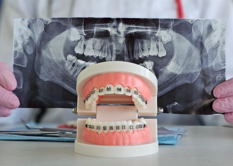 San Antonio Adult Orthodontist for a Healthier, More Confident Smile