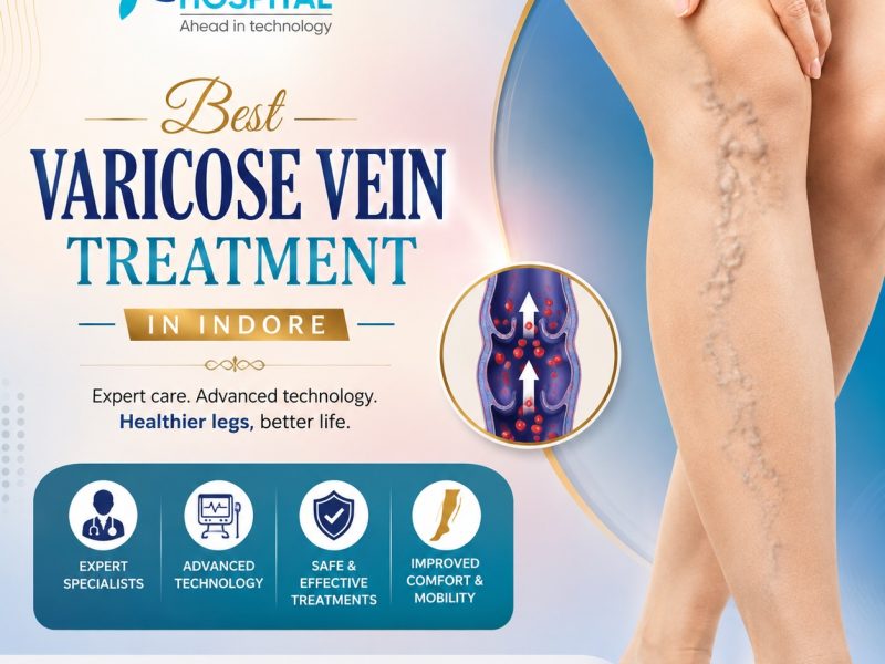 Best Varicose Vein Treatment in Indore - Sahaj Hospital
