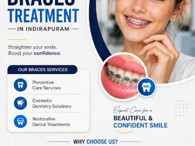 Braces Treatment in Indirapuram for Perfect Alignment