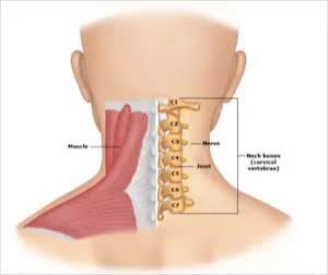 Cervical Spondylosis Treatment in Gurgaon | Expert Neck Pain & Spine Physiotherapy