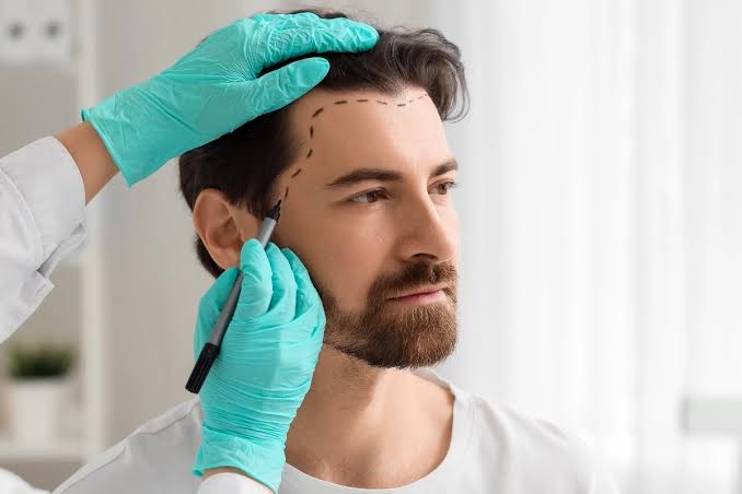 Activate Your Hair's Natural Power with PRP Treatment in Delhi!