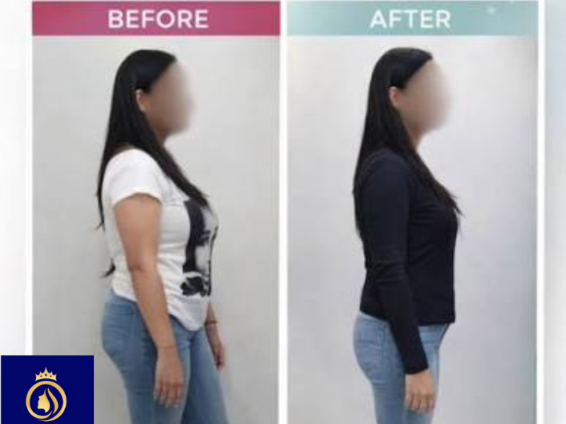 Achieve Your Body Goals with Fat Reduction in Thane – DNA Royal.
