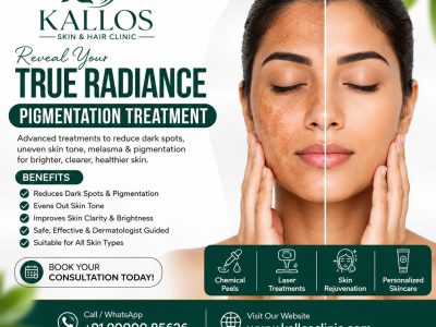Pigmentation Treatment in Hyderabad | Kallos Skin & Hair Clinic