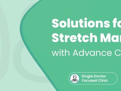 Laser Treatment for Stretch Marks | Advanced Skin Treatment