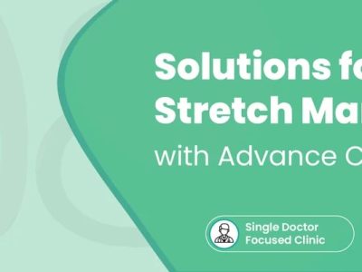 Stretch Mark Removal Treatment | Advanced Solutions for Smoother Skin