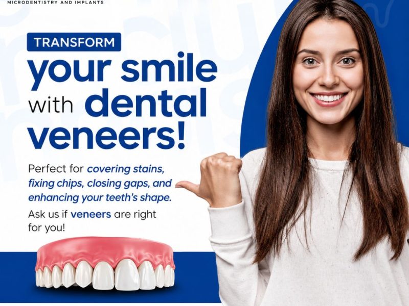 Dental Veneers Near You for Beautiful Smiles