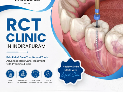 RCT Clinic in Indirapuram for Root Canal Treatment