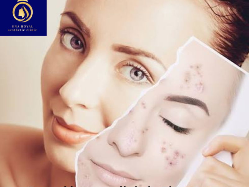 DNA Royal – Best Skin Care Clinic in Thane for Advanced Skin Treatments.