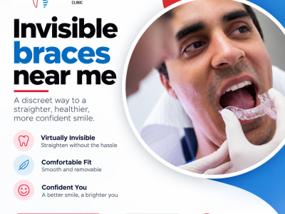 Invisible Braces Near Me for Discreet Teeth Alignment