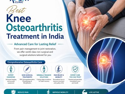 Best Knee Osteoarthritis Treatment in India - KneeXpert